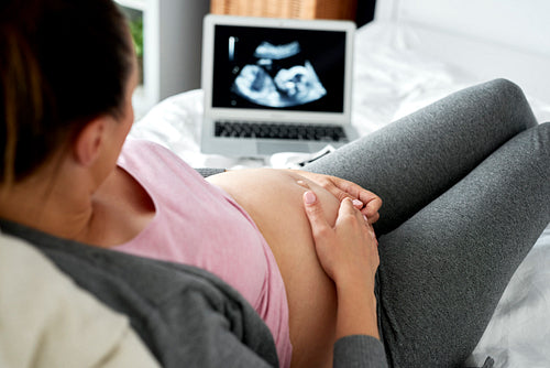 Pregnant woman watching ultrasound record on computer