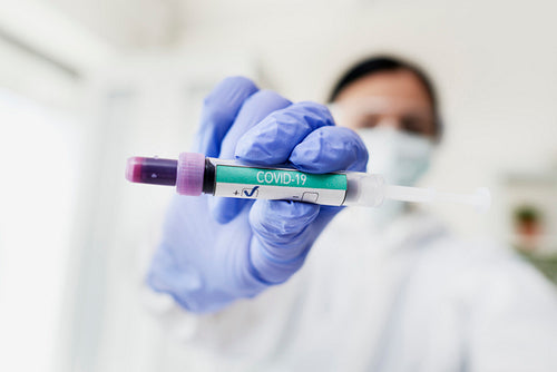 Technician showing a positive test tube of coronavirus